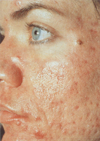 Hautarzt Lasertherapie Dermatologie Medizinische Kosmetik Hautarzt Nuernberg De